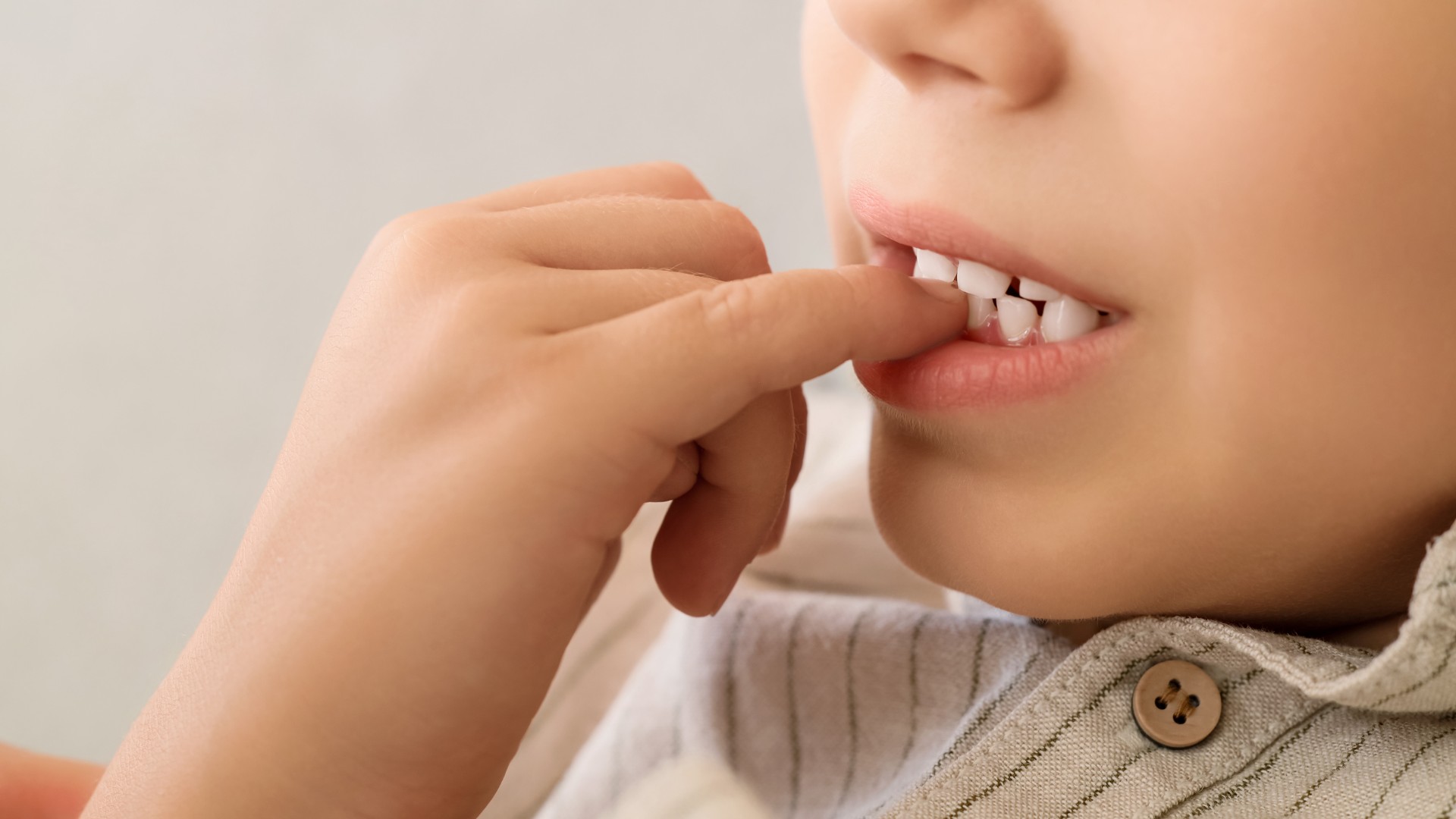 Ortodoncia Interceptiva Infantil en Santa Coloma: Corrige su sonrisa a tiempo