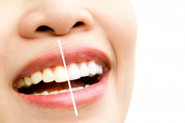 Cómo financiar tu tratamiento dental con Sonría